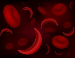 Base editing shows promise for treating sickle cell disease and beta thalassemia