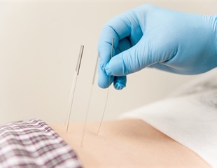 Acupuncture and acupressure may lead to better recovery in patients undergoing surgery for gynecologic cancers