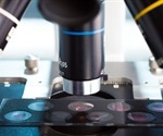 New design lets mini-microscope observe cells in vivo