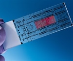 Lab-on-a-chip designed to predict woman's risk of preterm birth