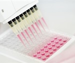 New semi-automated sample method facilities extraction of urine samples for LC-MS/MS analysis
