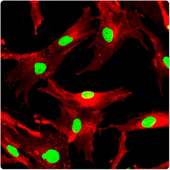 Mesenchymal stem cells labeled with fluorescent molecules. Image Credit - Shutterstock / Vshivkova