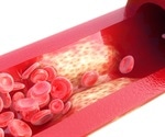 Moderate exercise in conjunction with common dietary supplements significantly reduce the risk of atherosclerosis