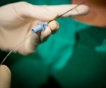 Novel dural puncture-sealing device decreases cerebrospinal fluid leakage