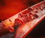 Dietary protein overload linked to increased atherosclerosis risk