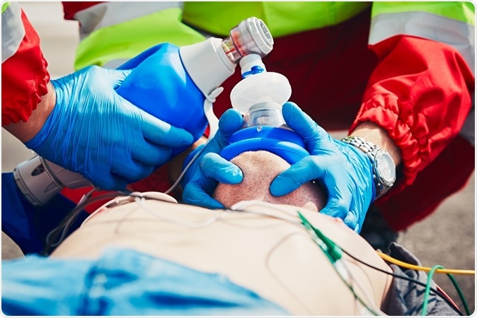 Cardiopulmonary resuscitation. Image Credit: Jaromir Chalabala / Shutterstock