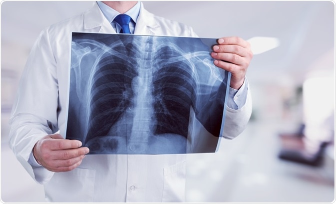 Respiratory Distress in a Patient with Clear Lungs: What You Need to Know