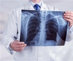 Walking Pneumonia: When to See a Doctor?