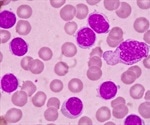 Next-gen BTK degrader could help overcome treatment resistance in chronic lymphocytic leukemia