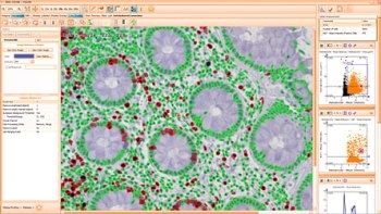 HistoQuest Image Analysis Software from TissueGnostics