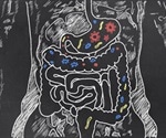 Gut bacteria may influence the response to certain cancer therapies finds study