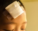 Tiny markers in saliva can be used to diagnose duration of a concussion in kids