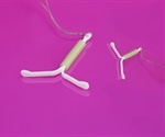 Intrauterine devices (IUDs) may lower risk of cervical cancer
