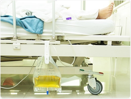Continuous urine flow measurements to prevent acute kidney injury