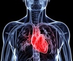 Broken Heart/Takotsubo Syndrome Cardiomyopathy