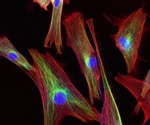 Researchers establish function of long RNA strands in skin development and disease