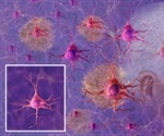 Studying Alzheimer’s at Single Cell Resolution