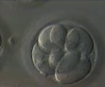 Stages of IVF