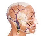 Needle electromyography can play a major role in face transplantation