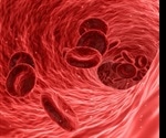 New research finds that statins may have potential role in lowering risk of venous thromboembolism