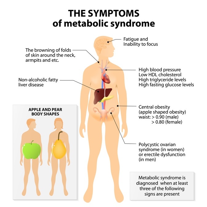 Metabolic syndrome, signs and symptoms. Image Credit: Designua / Shutterstock