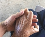 Leprosy Complications