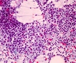 May hepatic granulomas be part of the histological spectrum of chronic hepatitis C?