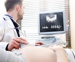 Small ultrasound sticker can monitor the stiffness of internal organs
