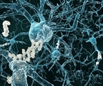 Vascular risk factors increase risk of Alzheimer's disease in late-life, study reveals