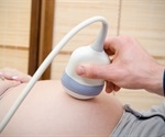 Study reveals multiple ultrasound scans are more pronounced in low-risk pregnancies