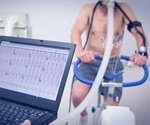Simple exercise test predicts mortality risk in heart failure patients