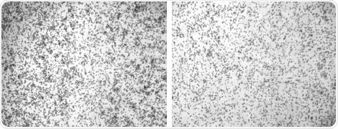 Weakly adherent cell line P815 before (left) and after washing (right) with PBS using Program 1