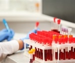 New data demonstrating the strength of Novartis' hematology portfolio to be presented