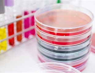 FUJIFILM Irvine Scientific Launches Heavy Oil for Embryo Culture: Optimized Protection for the IVF Laboratory