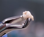 Bisphosphonates increase risk for bone disease after tooth extraction