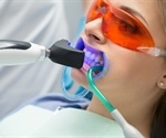 Why your dentist might seem pushy