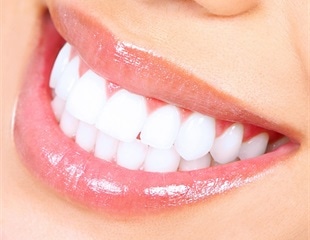 Tooth loss more frequent among Black women in Brazil