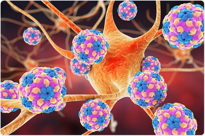 Human Parechoviruses affecting neuron, 3D illustration. Parechoviruses cause respiratory, gastrointestinal infections and are associated with brain damage and developmental disorders in neonates - Image Credit: Kateryna Kon / Shutterstock