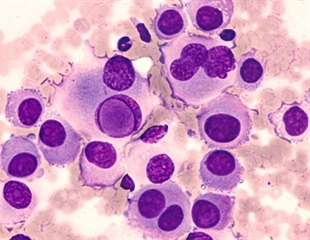 Single-cell transcriptome analysis provides insights into bat immunity