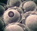 International society agrees that the potential of stem cells derived from fat show promising clinical uses
