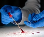 Forensic Laboratories introduces first oral fluid test for Tapentadol