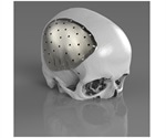 Surgeons to showcase Renishaw implant technology during masterclass at BAOMS conference