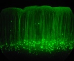 Super-resolution microscopy offers insight into the synapses