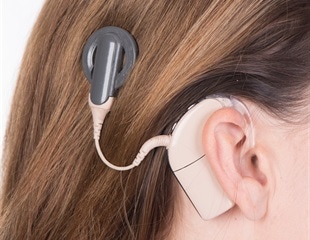 Researchers examine how aging impacts listening effort in cochlear-implant users