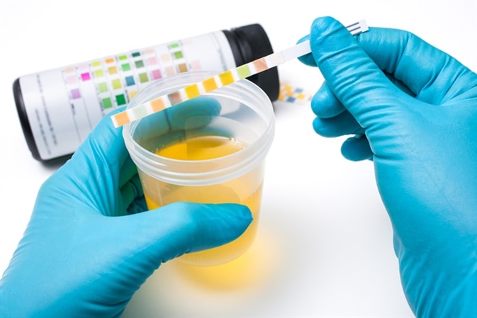Check-up. Medical report and urine test strips - Image Credit: Alexander Raths