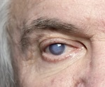 Signs and Risk Factors for Eye Disease