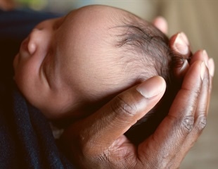 Report reveals differences in non-Hispanic black and white infant mortality rates in the US