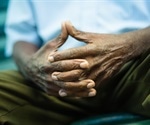 Racial disparity in dementia risk, experts report
