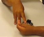 Eight year old successfully receives double hand transplant