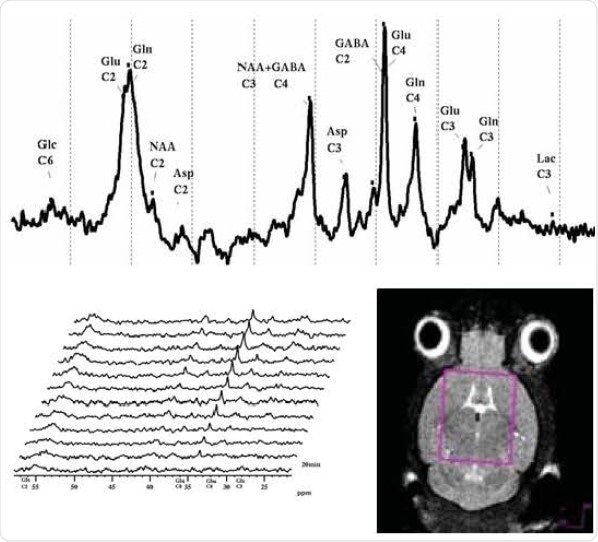 Localized 13C(1H} spectroscopy (ISIS) over time of mouse brain after orally administrated [1-13Cl] glucose.